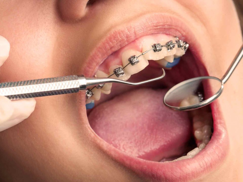 ortodontik tedavi