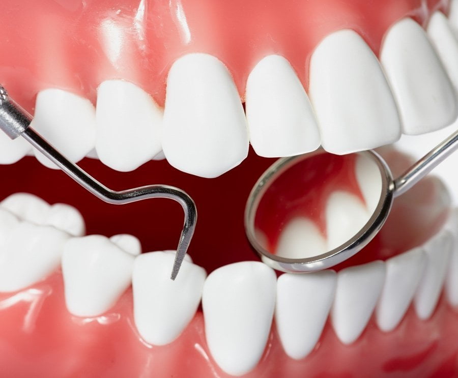 periodontoloji periodontal problemler nedir
