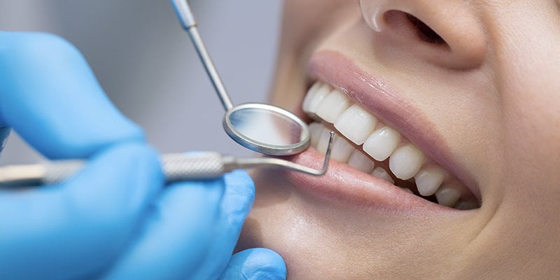 periodontoloji periodontal tedavi cesitleri