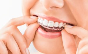 Ortodonti Neye Bakar ve Nedir